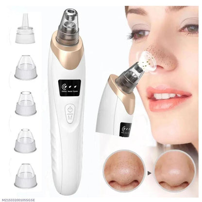 5-in-1 Rechargeable Blackhead Remover Vacuum | Deep Pore Facial Cleanser with Detachable Heads