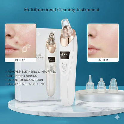 5-in-1 Rechargeable Blackhead Remover Vacuum | Deep Pore Facial Cleanser with Detachable Heads